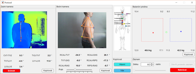 Software for postural stability evaluation