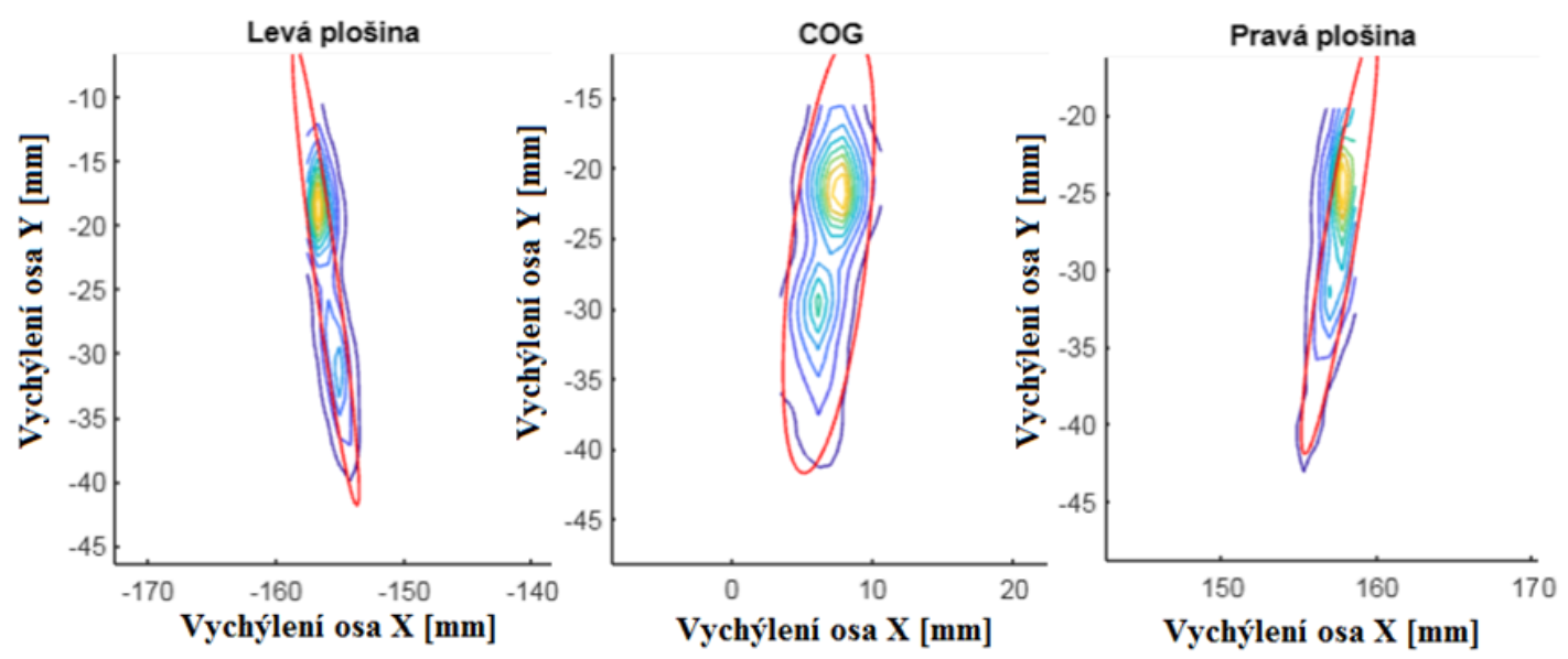 Evaluation of Center of pressure and Center of gravity during standing