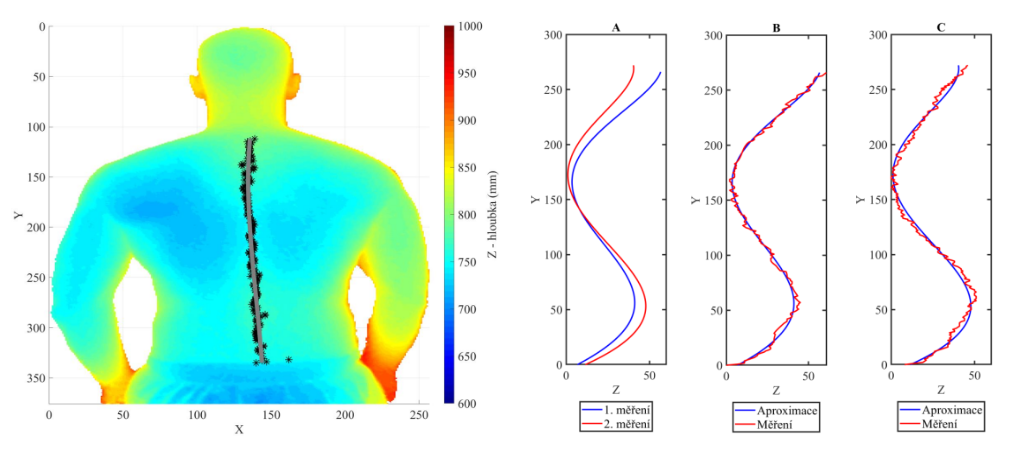 Evaluation of back morphology